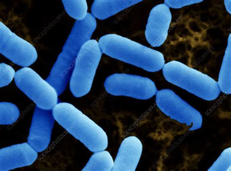 Lactobacillus casei - Stock Image - B220/1566 - Science Photo Library