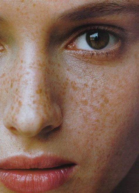 Freckles | Beautiful freckles, Freckles, Freckle face