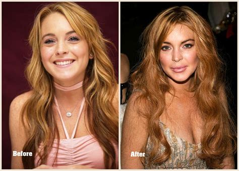 Hollywood Plastic Surgery Disasters - Inspiring Your Life