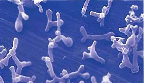Bifidobacterium animalis бактерии значение, пробиотики B. animalis