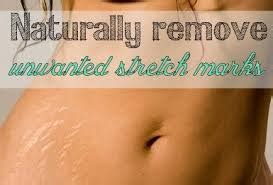 Article on How Effective Are Natural Remedies for Stretch Marks ...