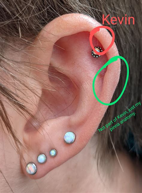 Kevin Update: 24hr post steroid injection and it looks like he's