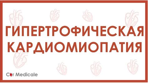Гипертрофическая кардиомиопатия - причины, механизмы, симптомы ...