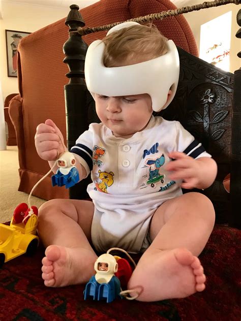 What Age Do Babies Wear A Helmet at Priscilla Scott blog