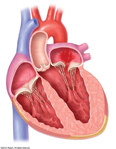 minimally invasive mitral valve surgery london mitral clinic