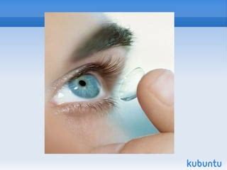 недостатоци на леќите | PPT