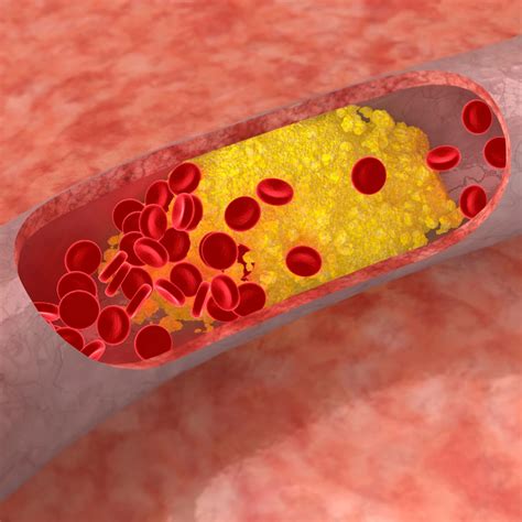 HDL Cholesterol? Alles over HDL cholesterol! - Vaud