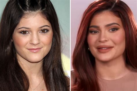 Kylie Jenner fans shocked by her changing face over the years as she ...