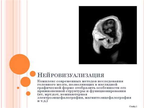 Нейровизуализация - презентация онлайн