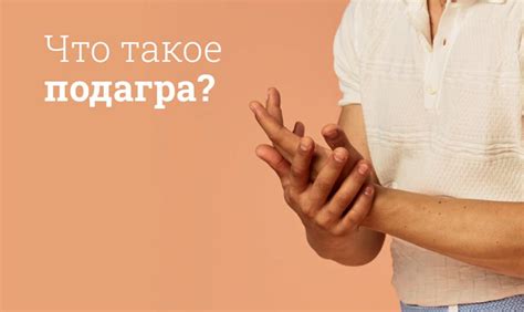 Подагра лечение и симптомы: Клинические рекомендации, психосоматика