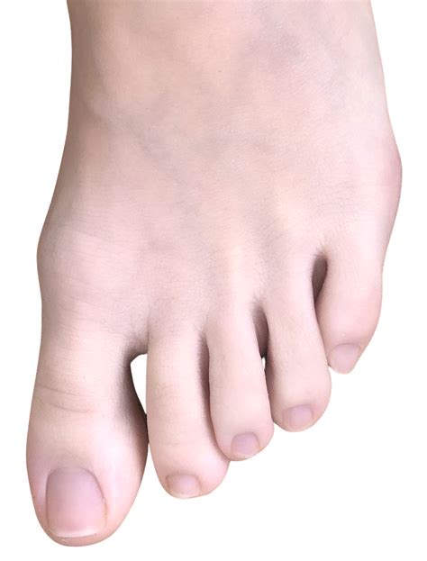 Toe - Wikiwand
