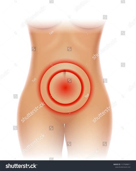 Female Abdominal Pain