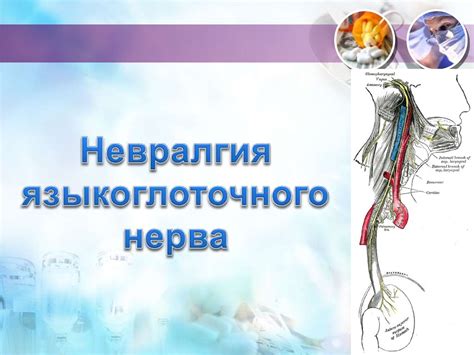 Невралгия лицевого и языкоглоточного нервов - презентация онлайн