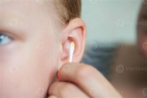 Cleaning the ears of a 5-year-old child from sulfur with cotton swabs
