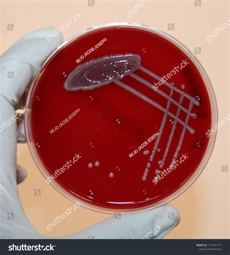 blood  shows gamma hemolysis royalty  images stock