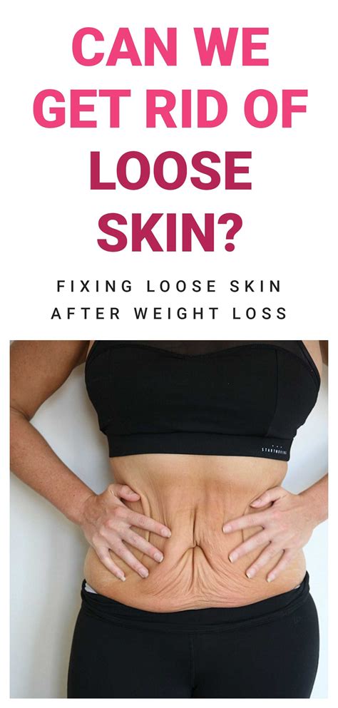 how to shrink skin after weight loss 8