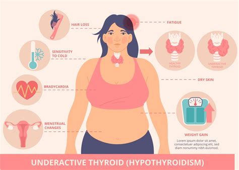 how to know if i have hypothyroidism