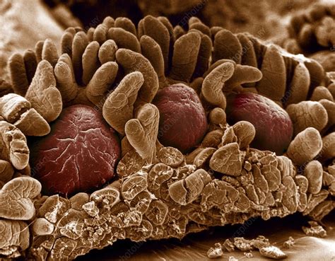 Peyer's patches, SEM - Stock Image - C009/5652 - Science Photo Library