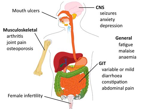 Coeliac disease | OverPath