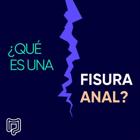 Fisura Anal - Dr. Luis Enrique Sánchez