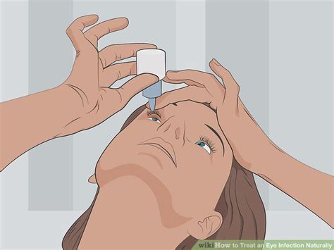 how to treat a eye infection at home
