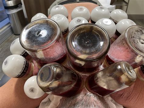 Download Free The Complete Guide To Cupping Therapy 8