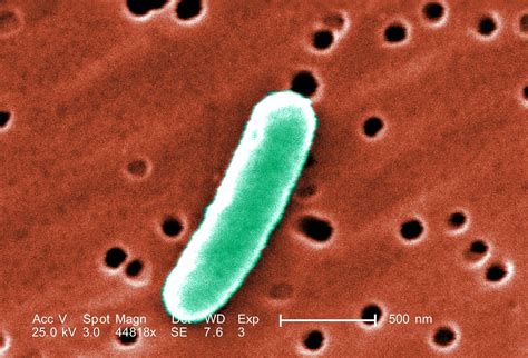 escherichia coli gambar gratis