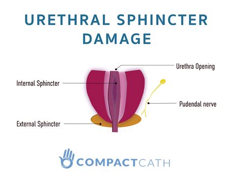 Sore Sphincter: Anal Pain Causes – Mayo Clinic