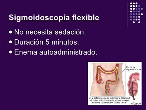 Screening Sigmoideoscopia del cancer colorectal
