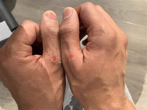 When you forget to wear your gloves at the gym. : r/mildlyinfuriating