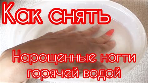 Как снять НАРОЩЕННЫЕ НОГТИ ГОРЯЧЕЙ ВОДОЙ в Домашних условиях - YouTube