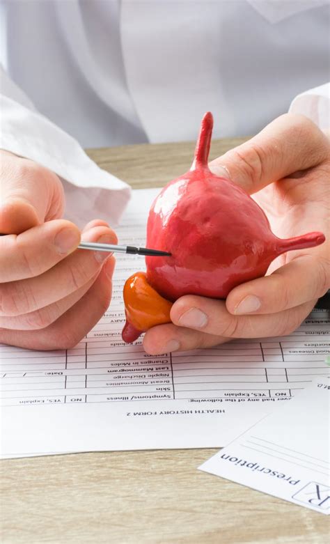 Bladder Cancer Treatment - Charleston Oncology