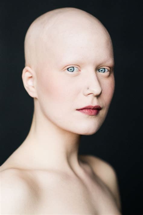 stunning portraits  women  alopecia redefine femininity bald