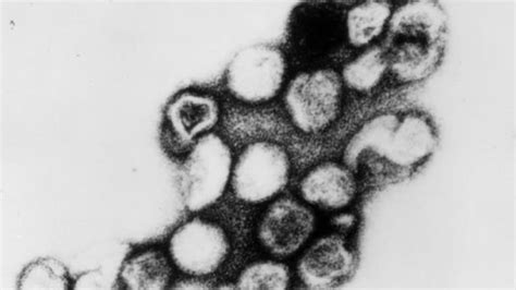 What is Rubella? | Mental Floss