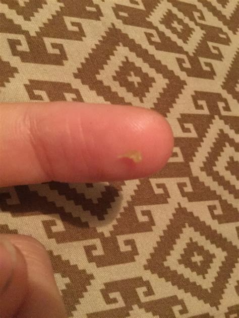 Just squeezed an enormous blackhead from my ear. Too bad I couldn’t see