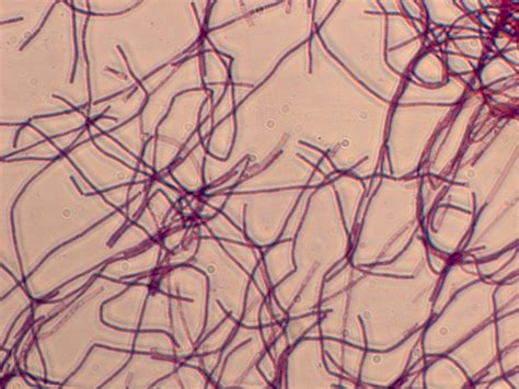 assuming    bacillus anthracis