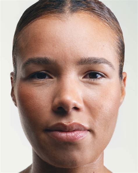 Fibrous Papule: How to Eliminate it?