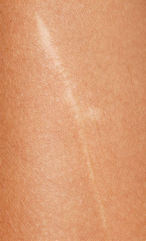 The Skin We're in - Elise Dumontet