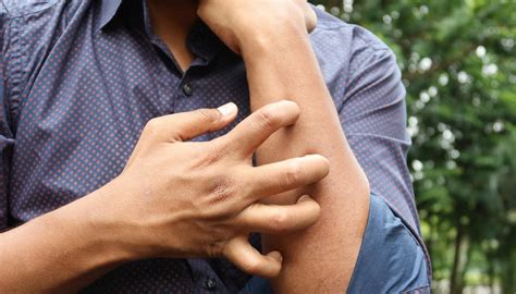Qual Dst Causa Coceira No Corpo - Coceira no corpo: o que pode significar? Conheça causas - Tá Saudável