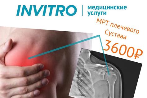 ИНВИТРО Старый Оскол - Home | Facebook