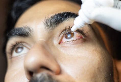 Amid Recalls, Are Eye Drops Safe to Use? - The New York Times