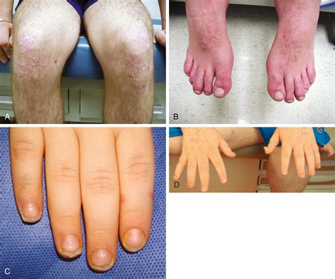 Rheumatology - Clinical Tree