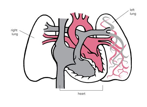 Unhealthy Heart Diagram Heart Disease Stock Photo - Image: 61239170