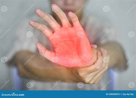 Painful Palm Of Asian Man. Concept Of Compartment Syndrome, Cellulitis ...