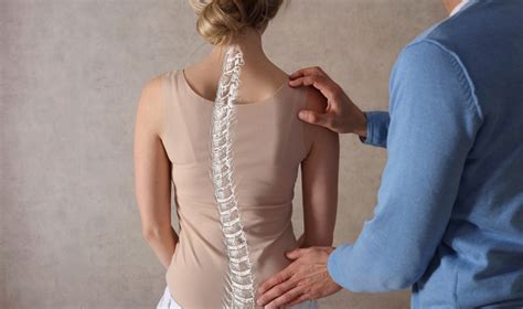 tips  exercises  posture improvement  expert
