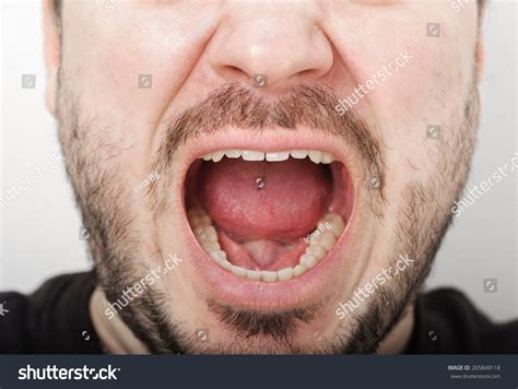 Open Mouth Teeth