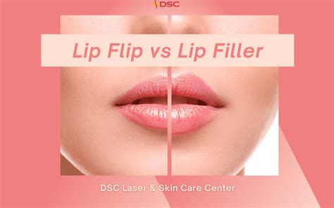 Lip Flip vs Lip Filler - DSC Laser & Skin Care Center