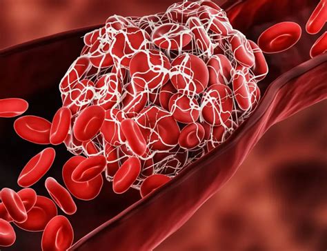 Този лек с мед топи кръвни съсиреци | Actualno.com