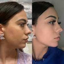 top  tips   sharp jawline