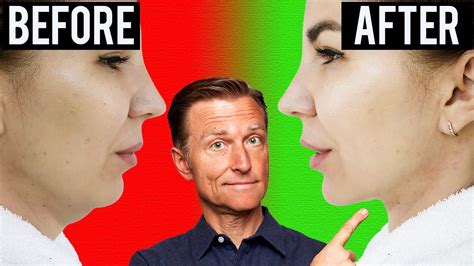 4 Exercises To Get Rid Of A DOUBLE CHIN!